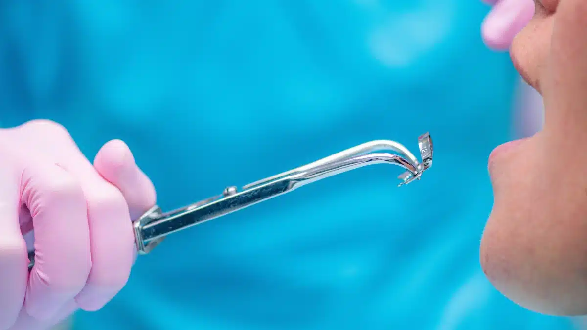 ¿Qué es una endodoncia de muela y para qué sirve?