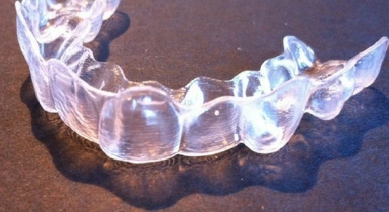 alineador-invisalign-3