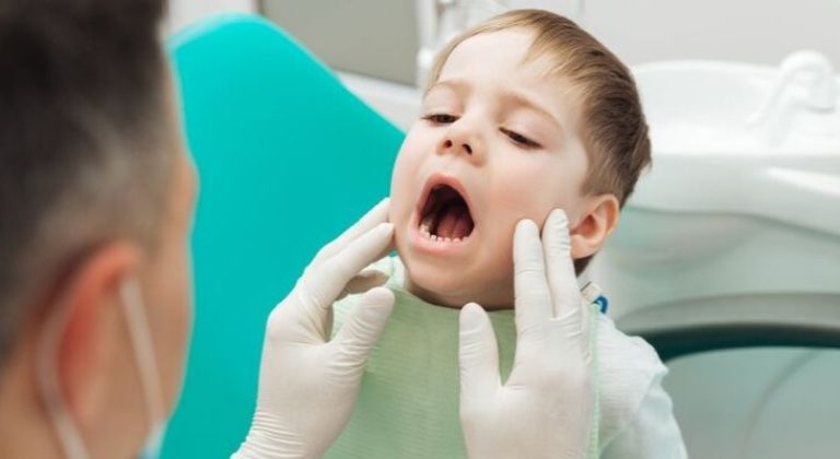 caries-infantil-min