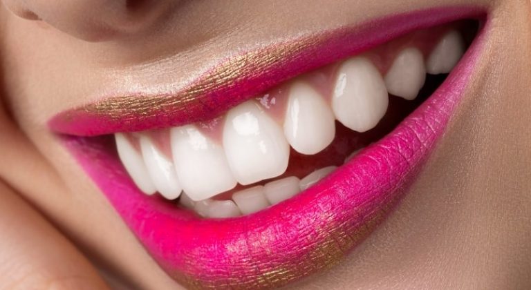 consejos-de-blanqueamiento-dental-1-min